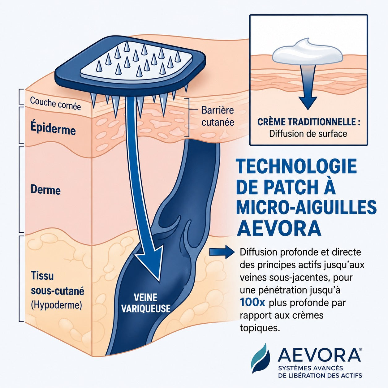 Technologie micro-aiguilles botaniques Aevora - livraison actifs profond tissu veineux